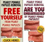 pearly-penile-papules-banner combined - Traitements, Conseil